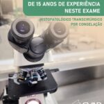 Hispatologico Transcirúrgico por Congelação